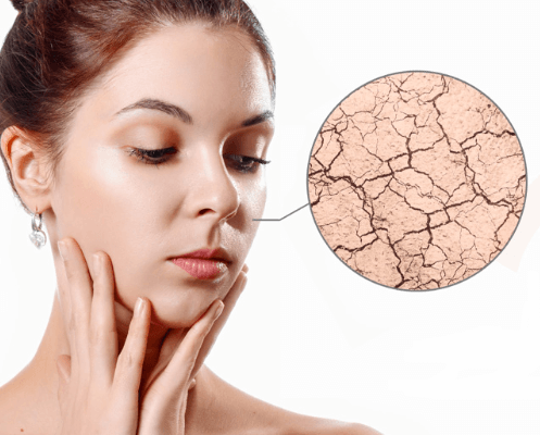 Khăn ướt giá rẻ sẽ làm tình trạng da bạn tệ đi