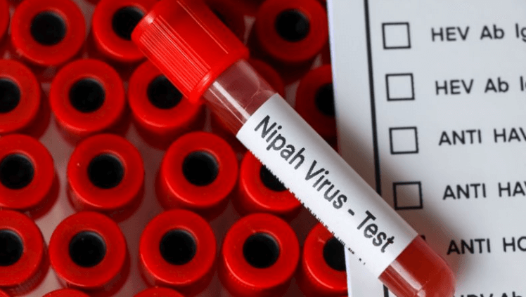 Virus Nipah: Nguy cơ, cách lây truyền và phòng chống 5 Vẫn thuốc điều trị chưa có kết quả rõ ràng